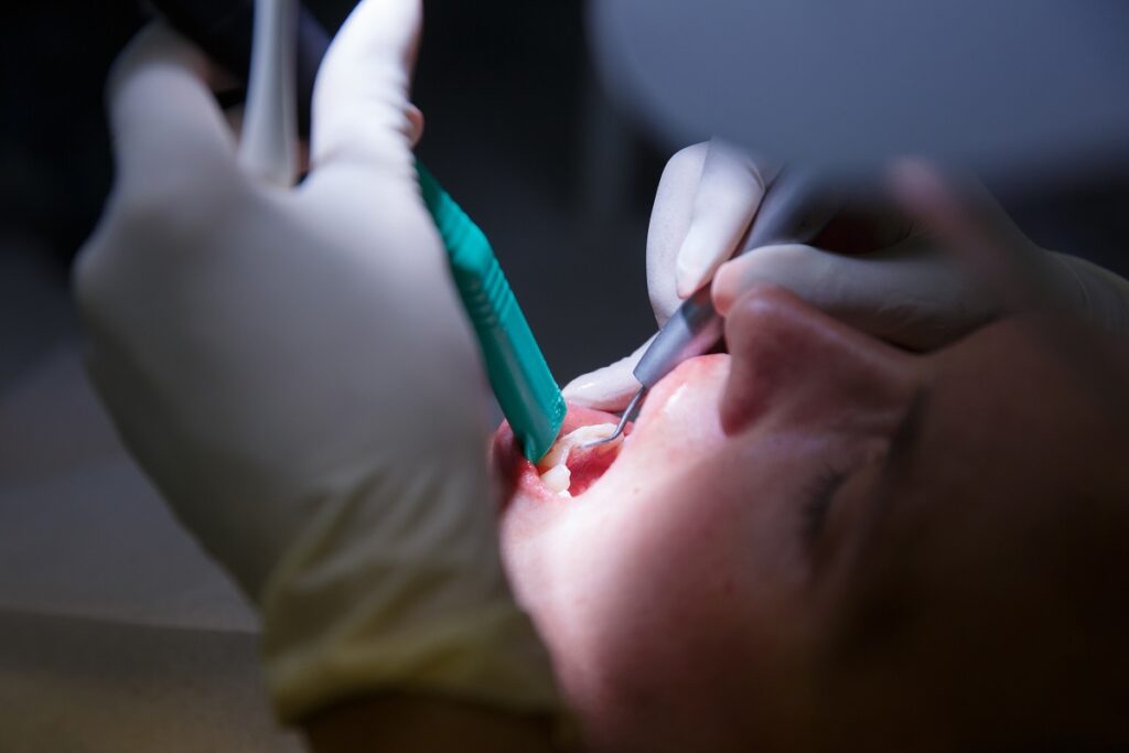 a dentist removing tartar and plaque