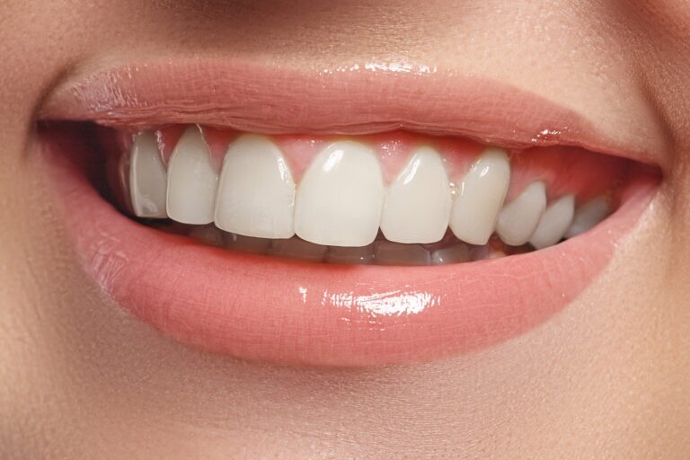 a woman with white teeth